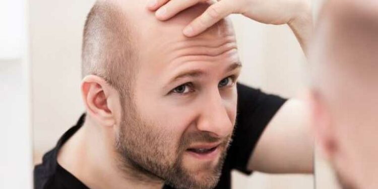 липсата на коса